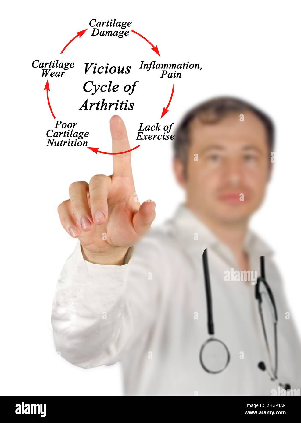 Steps in Vicious Cycle of Arthritis Stock Photo - Alamy