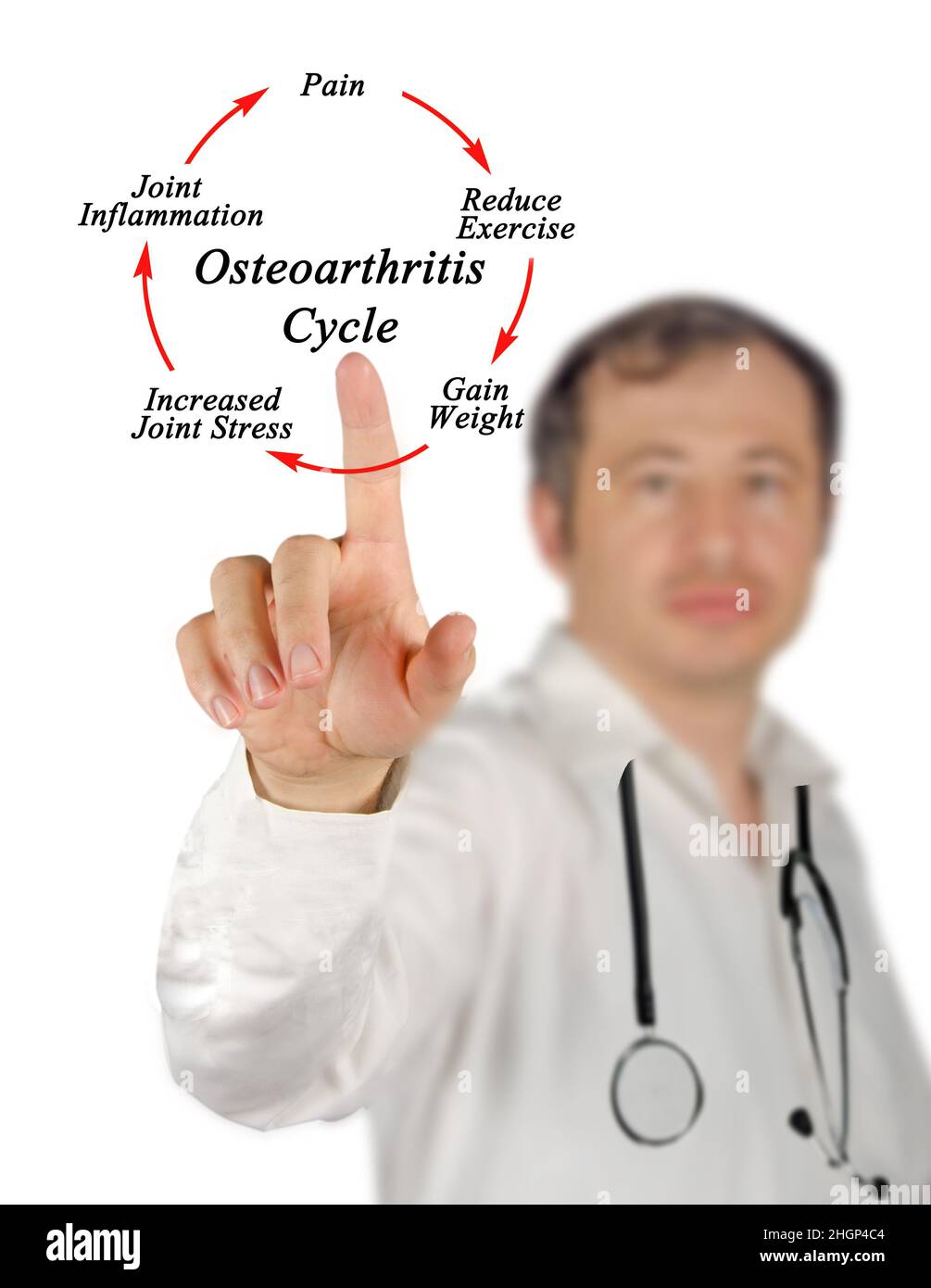 Five components of Osteoarthritis Cycle Stock Photo Alamy