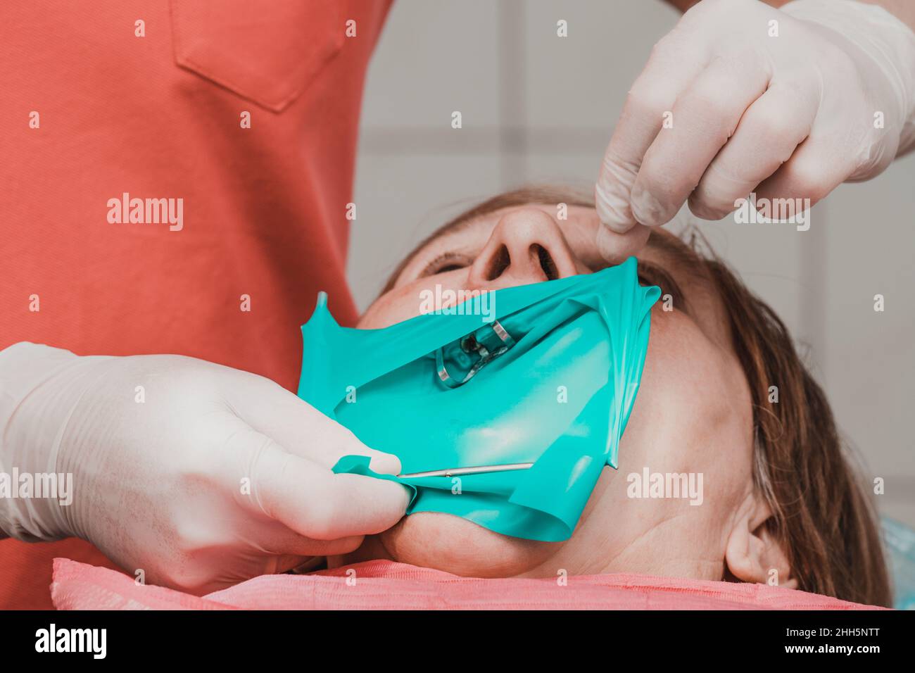 Dental treatment at the dentist, the doctor treats the patient's upper