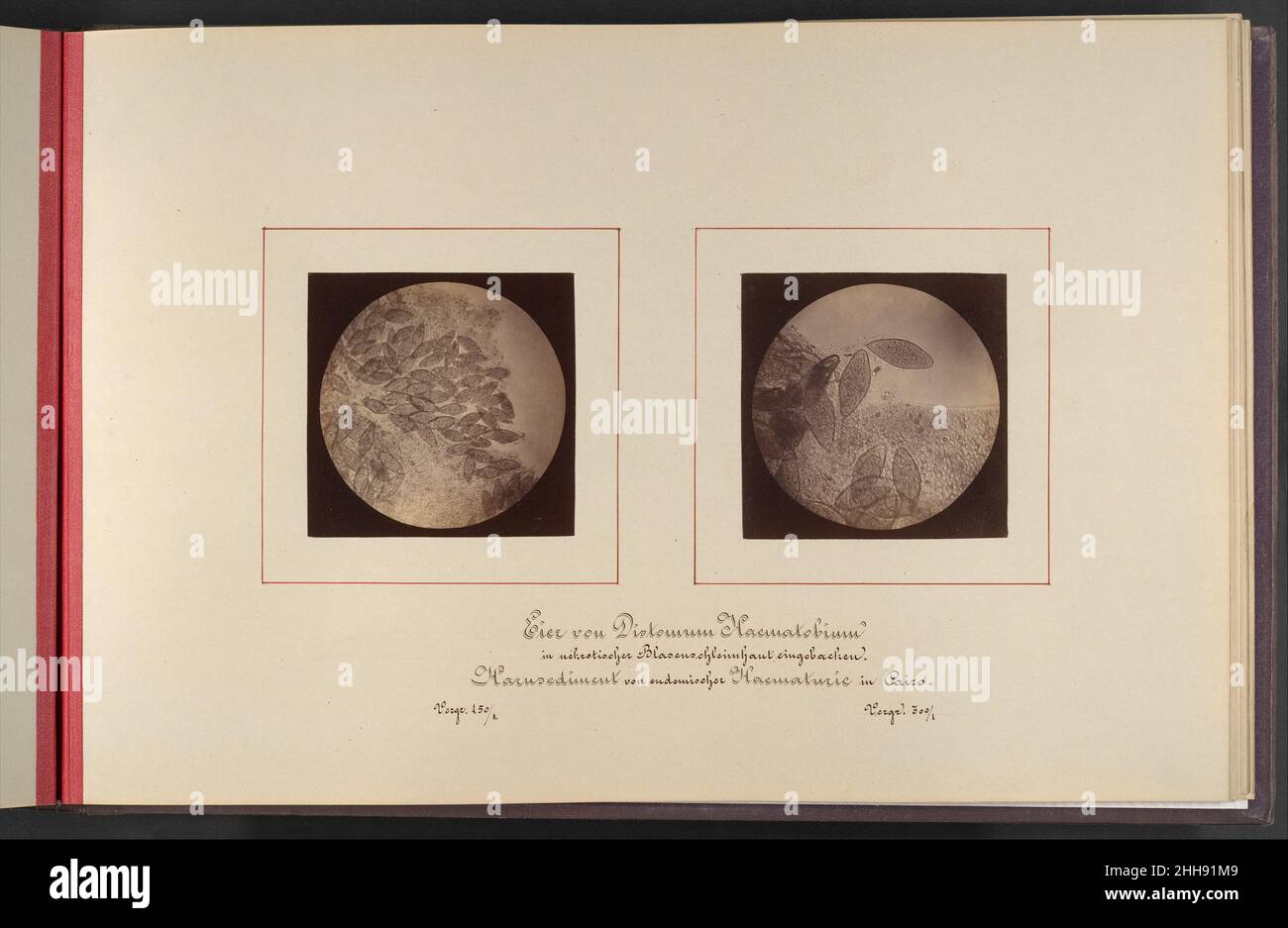 Mikroskopisch-Photographischer Atlas der Harnsedimente 1869 Robert Ultzmann Austrian. Mikroskopisch-Photographischer Atlas der Harnsedimente  287306 Stock Photo