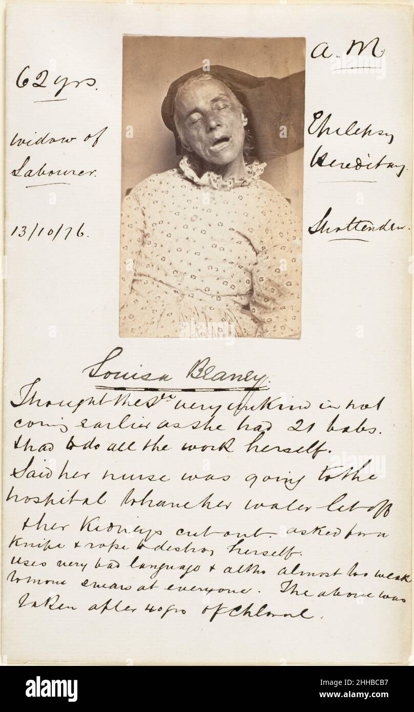 Louisa Blaney 1870s Unknown A sobering foil to the cartes-de-visite of the celebrated and powerful, these records from an unidentified British insane asylum exemplify the 19th century’s varied uses of the medium as a means of diagnosis, surveillance, and social control. The photography of mental illness has its roots in the physiognomic research of Johann Kaspar Lavater (1741-1801), who believed that diverse forms of madness could be read in the individual’s physical features. Emblems of Victorian repression, these kinds of pictures actually served multiple purposes: as a record of the patient Stock Photo
