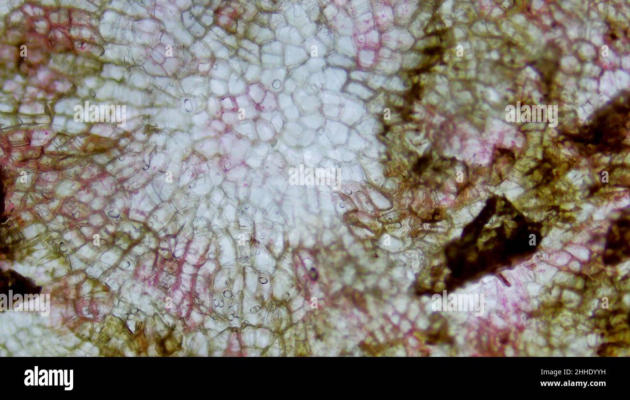 Potato under the microscope Stock Photo Alamy