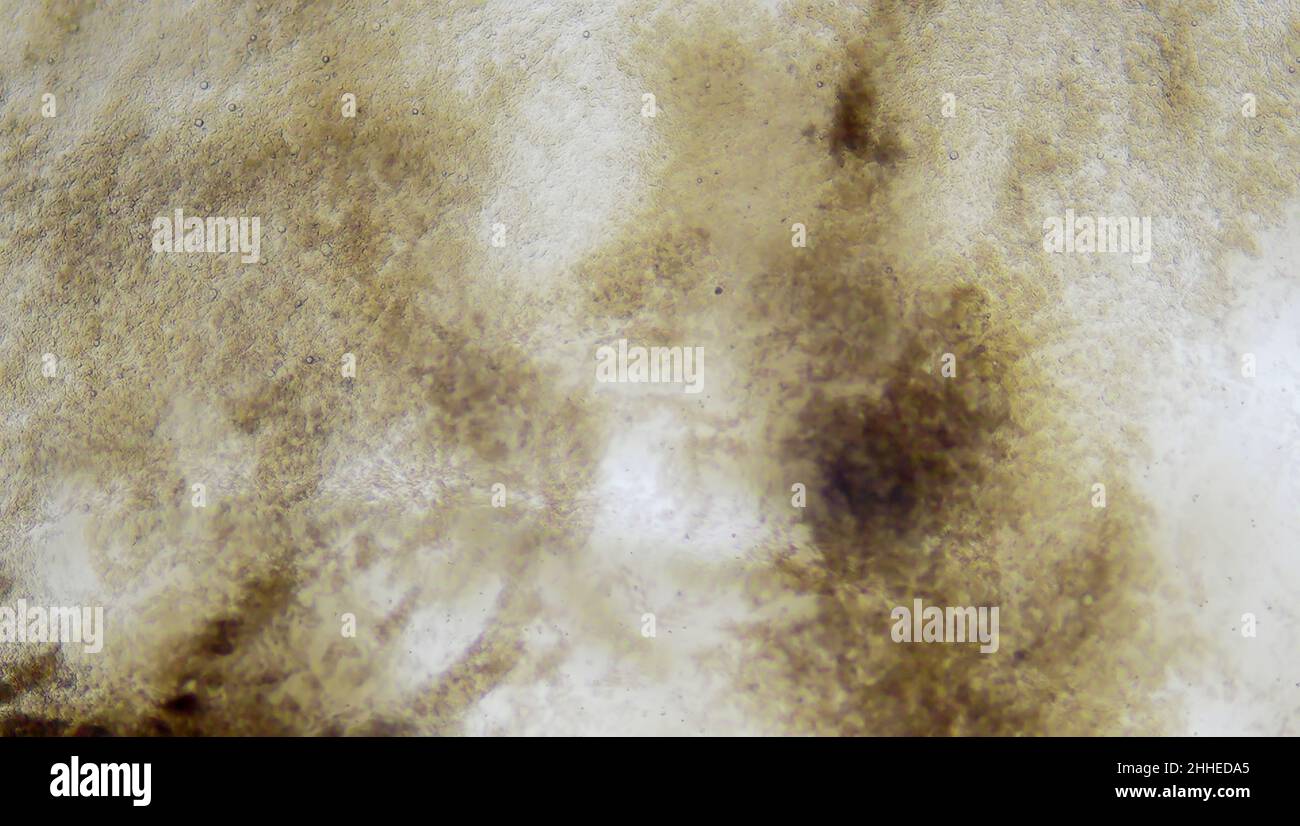 Egg yolk under the microscope Stock Photo - Alamy