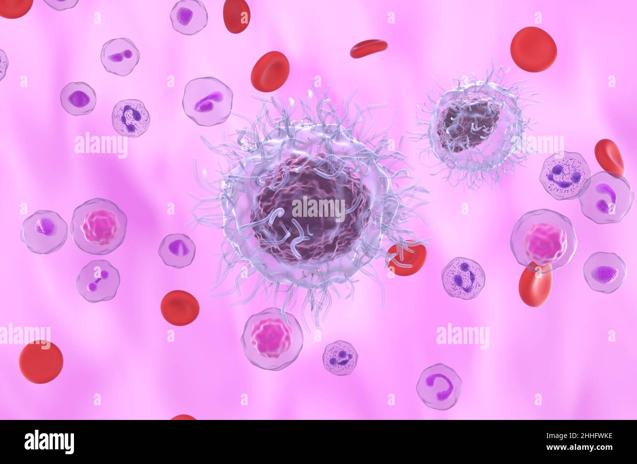 Hairy Cell Leukemia (HCL, HZL) cells in blood flow - isometric view 3d illustration Stock Photo