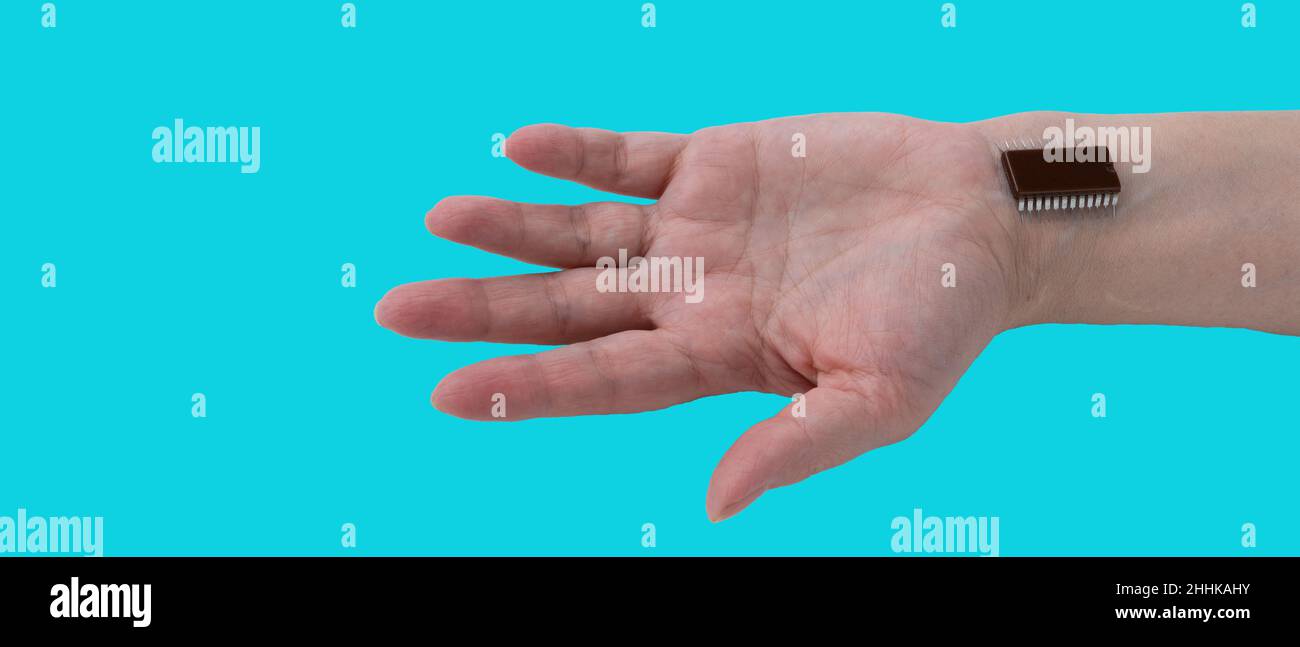 microchip is connected to a woman hand. implantation of a chip under