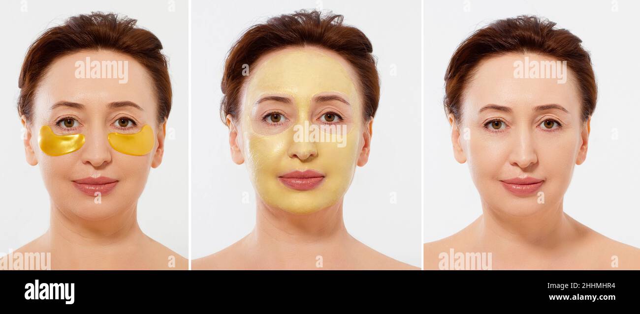 Macro female face before after beauty treatment. Middle aged woman. Beauty portrait of middle age women with wrinkles and a gold patch under eye, face Stock Photo