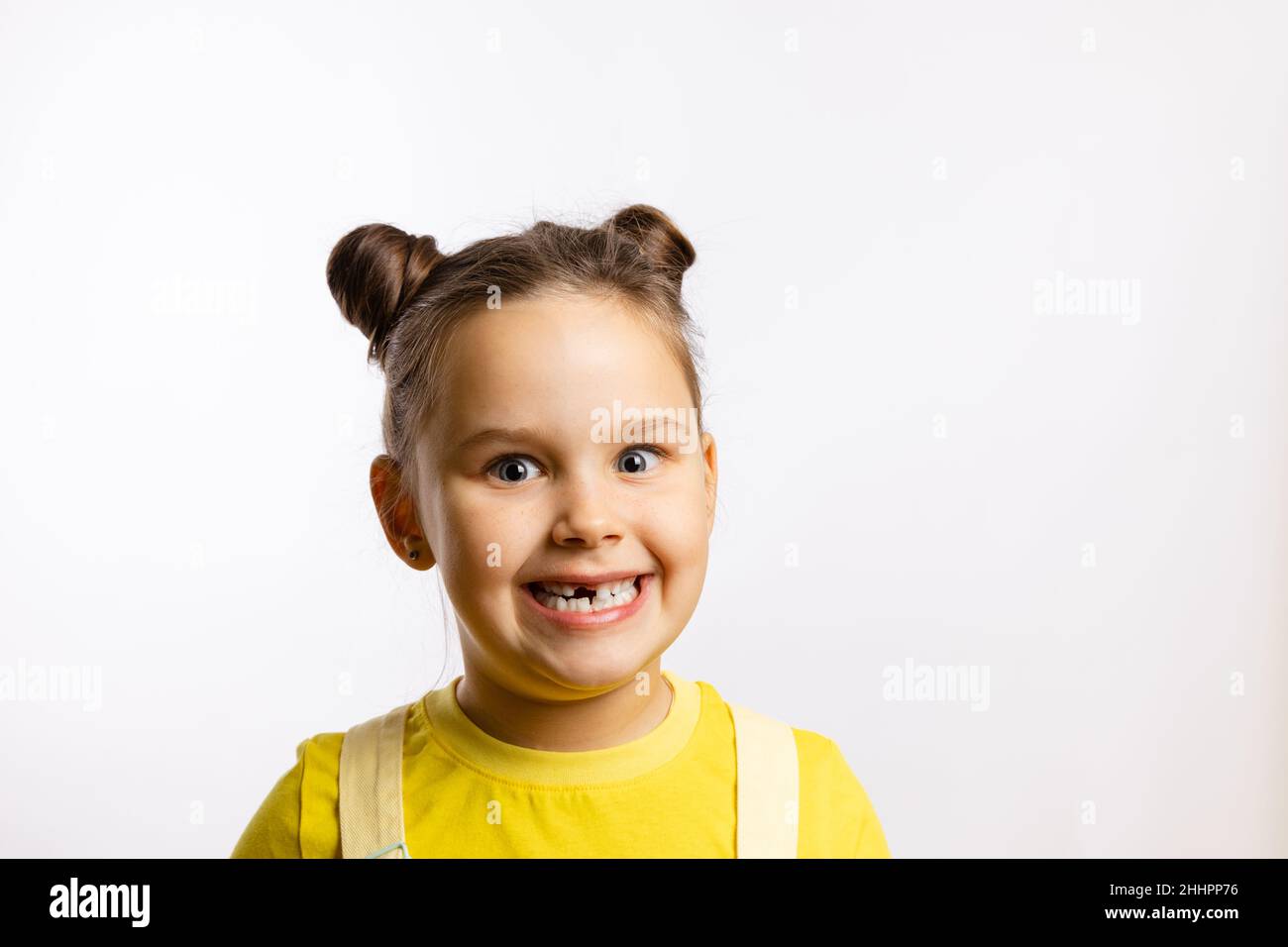 Close-up of shining little girl showing missing front baby tooth and smiling crazily in yellow t-shirt on white background. First teeth changing Stock Photo