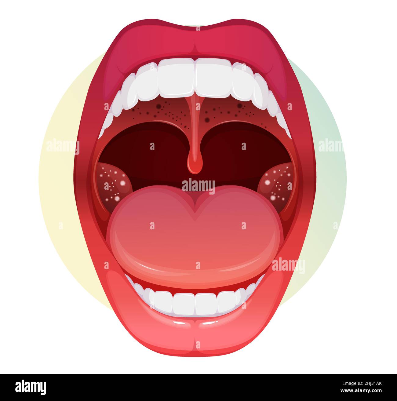 Open Mouth with Sore Throat and Tonsillitis  - stock illustration as EPS 10 File Stock Vector