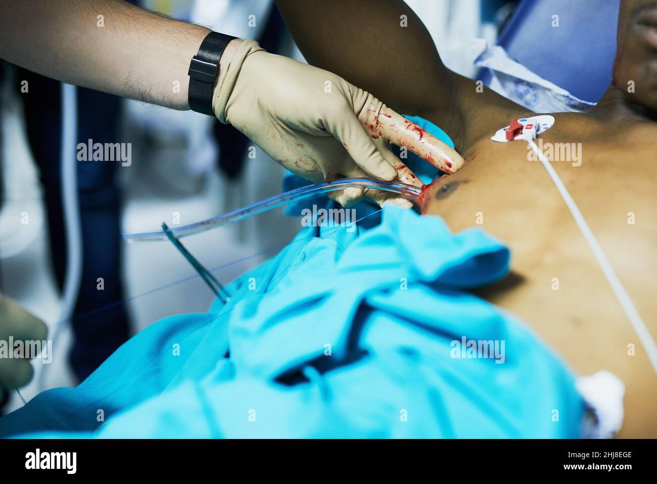 Restoring respiratory function with chest drainage. Cropped shot of a doctor inserting a tube into a patients chest in an emergency room. Stock Photo