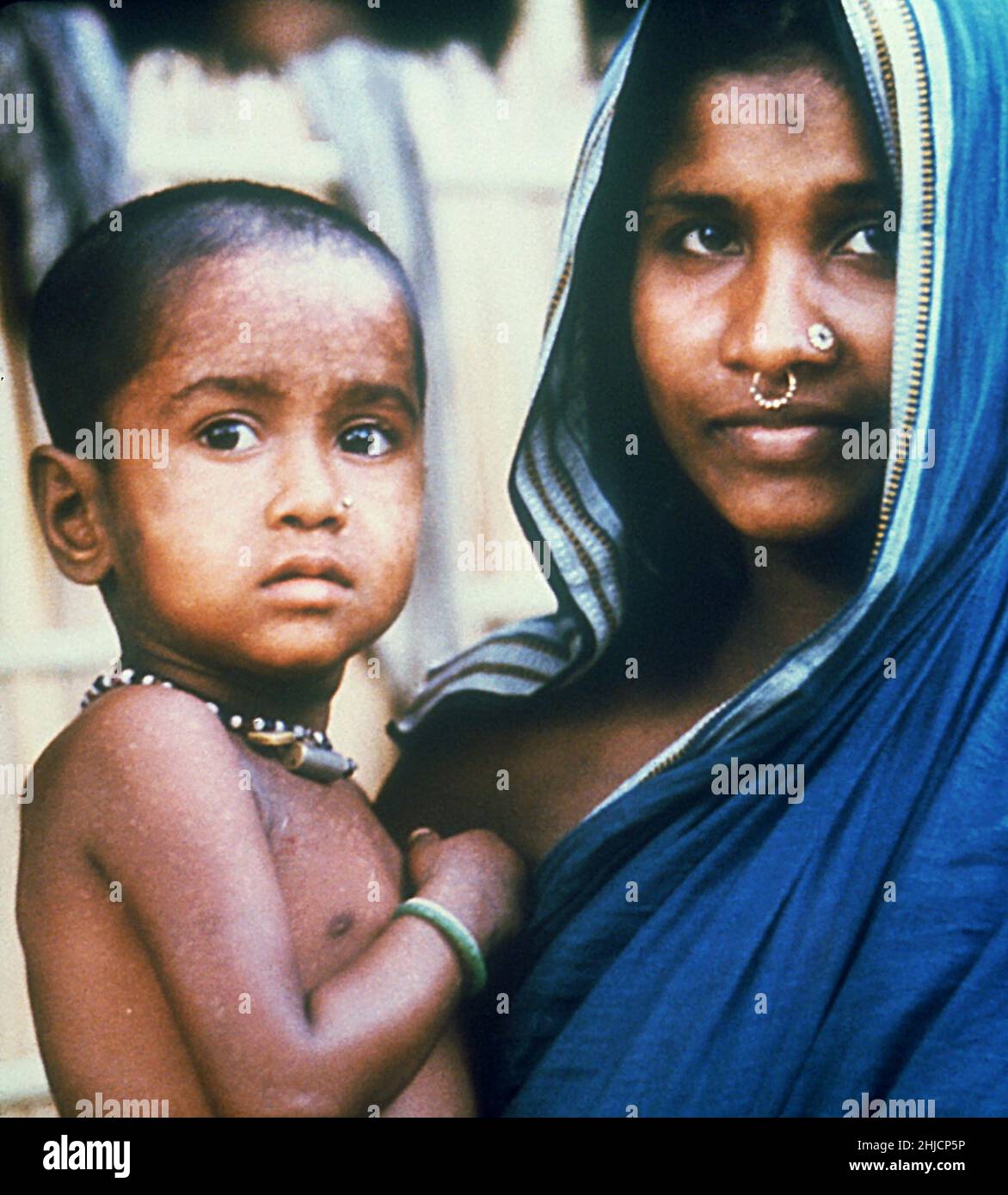 Shown here with her mother, 2-year-old Rahima Banu had the world's last recorded case of the most virulent form of smallpox, Variola major. Taken in the village of Kuralia, on Bhola Island, in the Barisal District of Bangladesh, on October 16th, 1975. Stock Photo