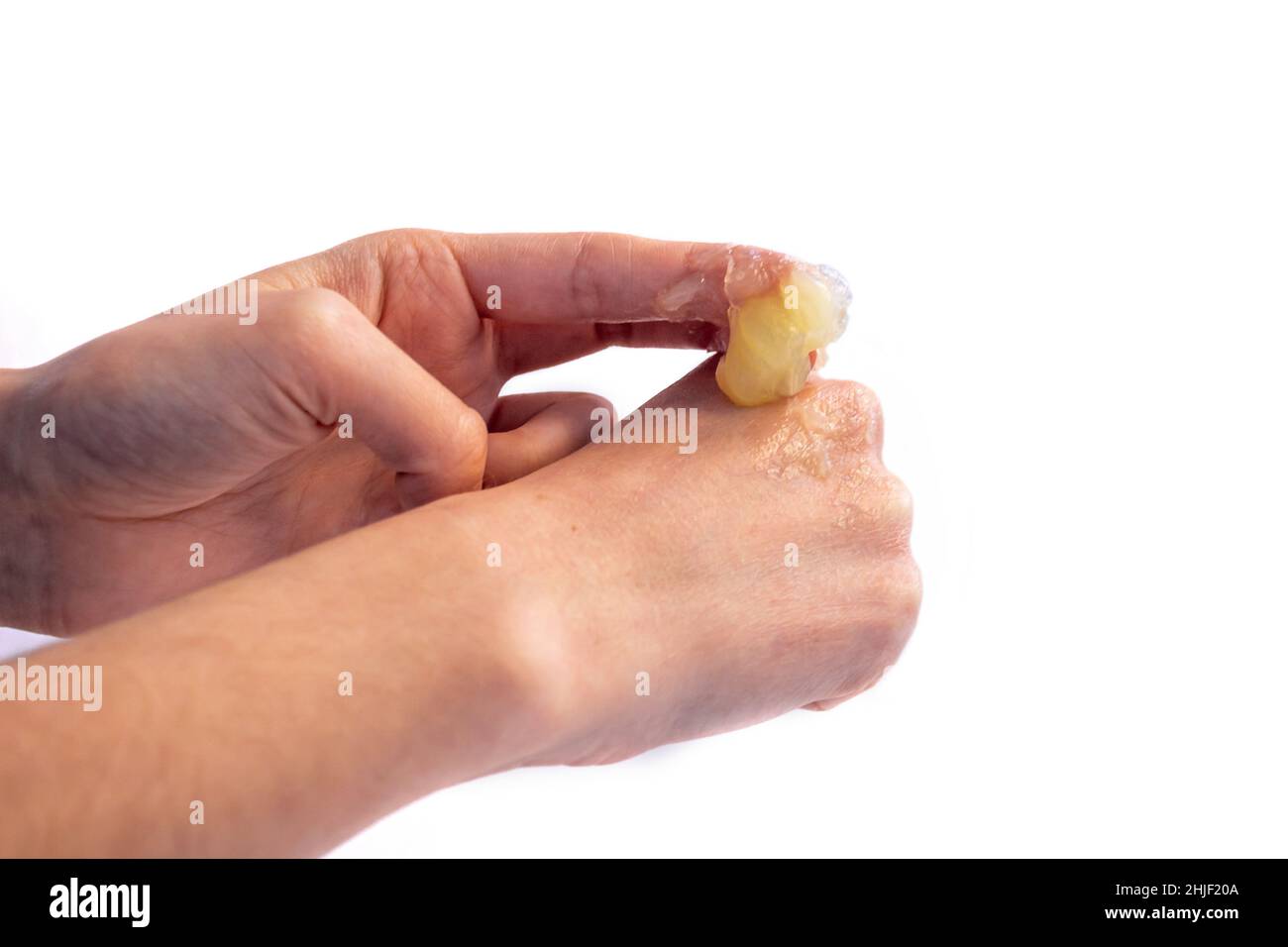 Woman applying petroleum jelly on her hand isolated on white background. Young girl doing skincare with moisturizing cream. Stock Photo