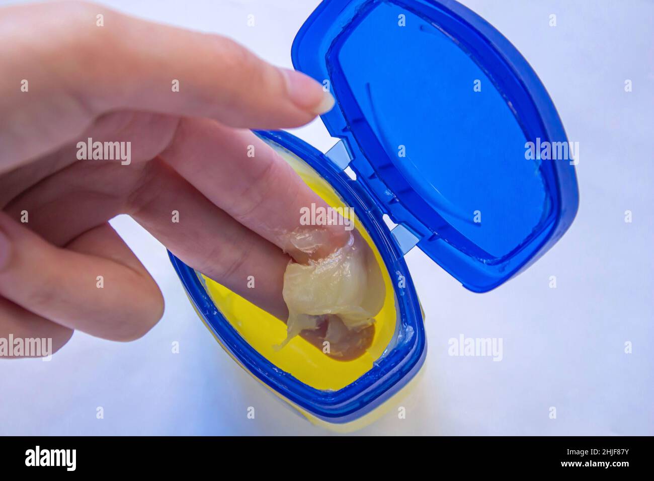 Woman using petroleum jelly. Young girl doing skincare with moisturizing cream. Stock Photo