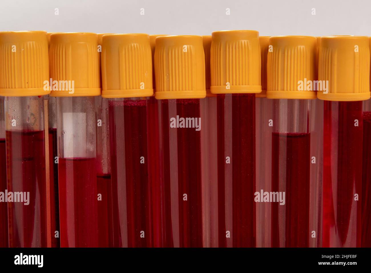 blood collection tube lined up, all ready for testing Stock Photo