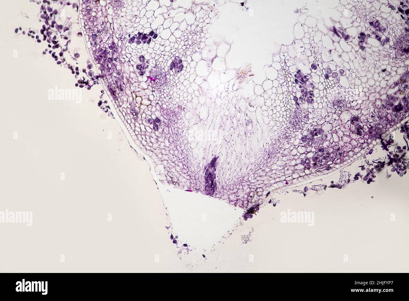 Peronospera transverse section on a host as viewed through a light microscope Stock Photo