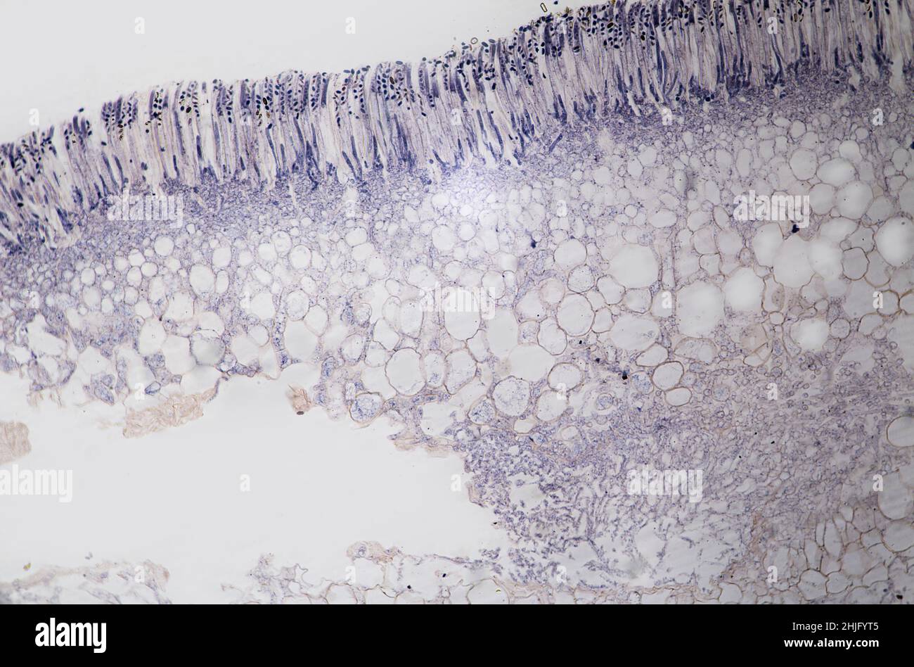 Peziza (fungi) Longitudinal section as seen through a light microscope Stock Photo