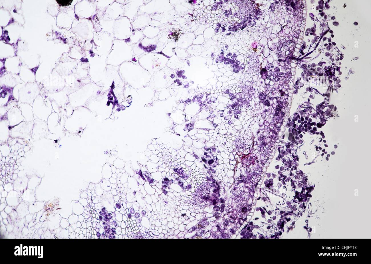 Peronospera transverse section on a host as viewed through a light microscope Stock Photo