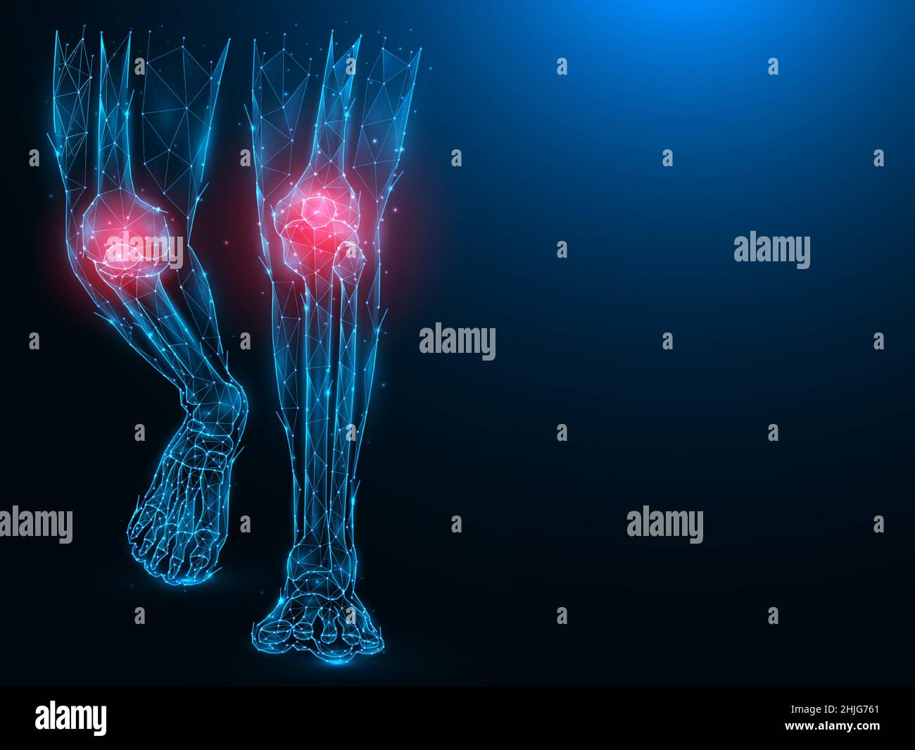 Polygonal vector illustration of human legs, painful and inflamed knees. Sick knees concept