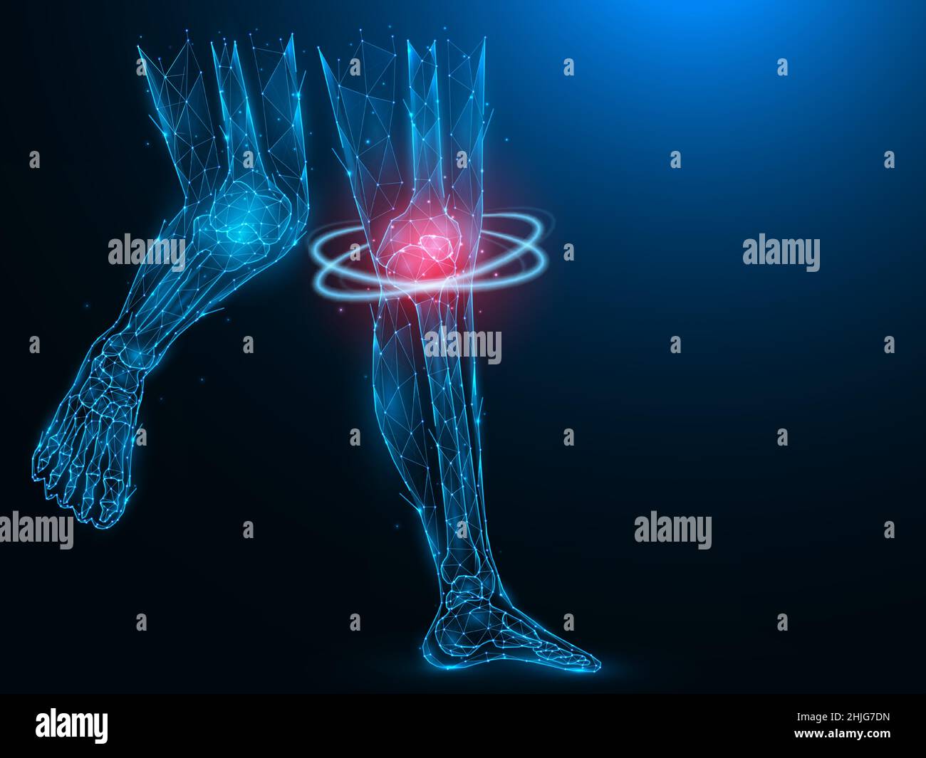 Polygonal vector illustration of human legs, painful and inflamed knee. Sick knee recovery