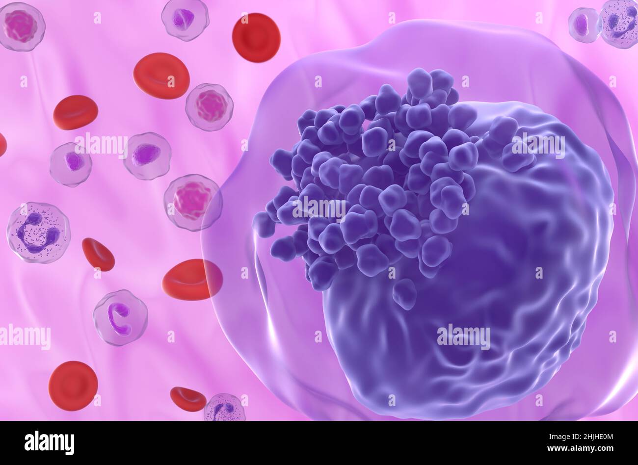 Acute myeloid leukemia (AML) cell in blood flow - super closeup view 3d illustration Stock Photo