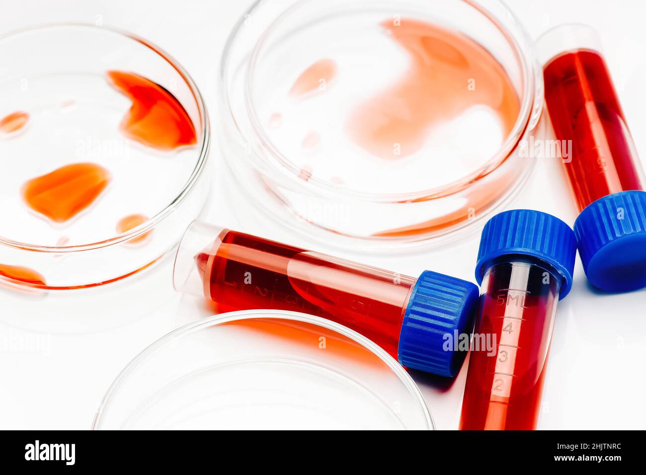Petri dish and test tubes with blood in the laboratory. Blood ...