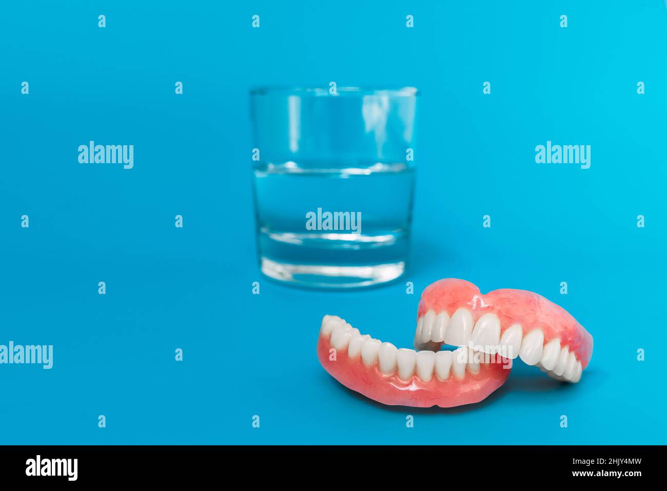 Full removable plastic denture of the jaws. A set of dentures on a blue background. Two acrylic dentures. Upper and lower jaws with fake teeth. Dentur Stock Photo