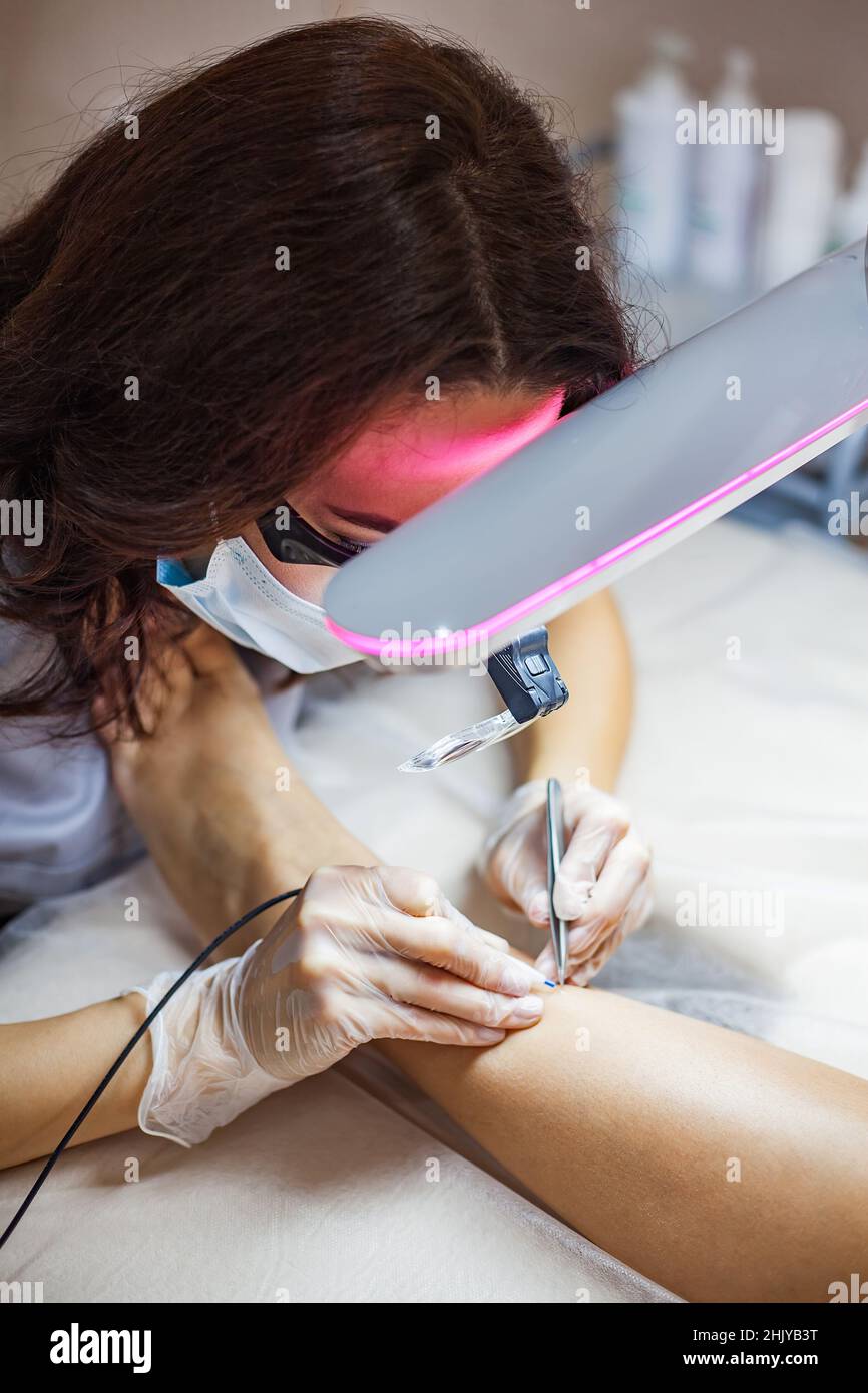 A female cosmetologist performs the procedure of permanent removal of unwanted hair on the client's legs by electroepilation. Stock Photo