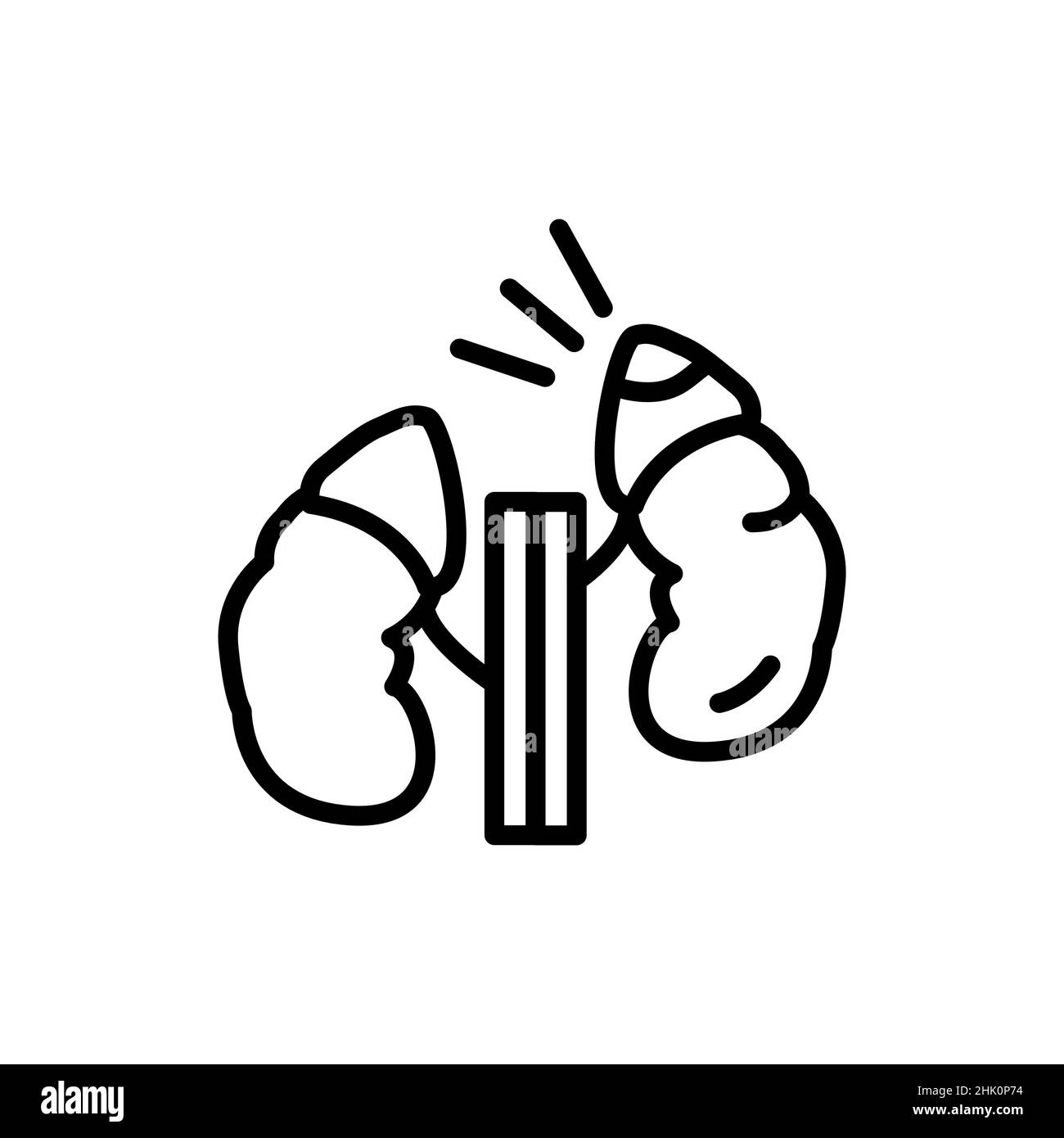 Cushing cortisol syndrome color line icon. Isolated vector element. Outline pictogram for web page, mobile app, promo Stock Vector