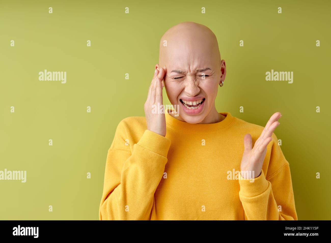 Bald annoyed caucasian lady touching head with fingers, suffering from headache. isolated on green studio background, unhappy angry hairless female sc Stock Photo