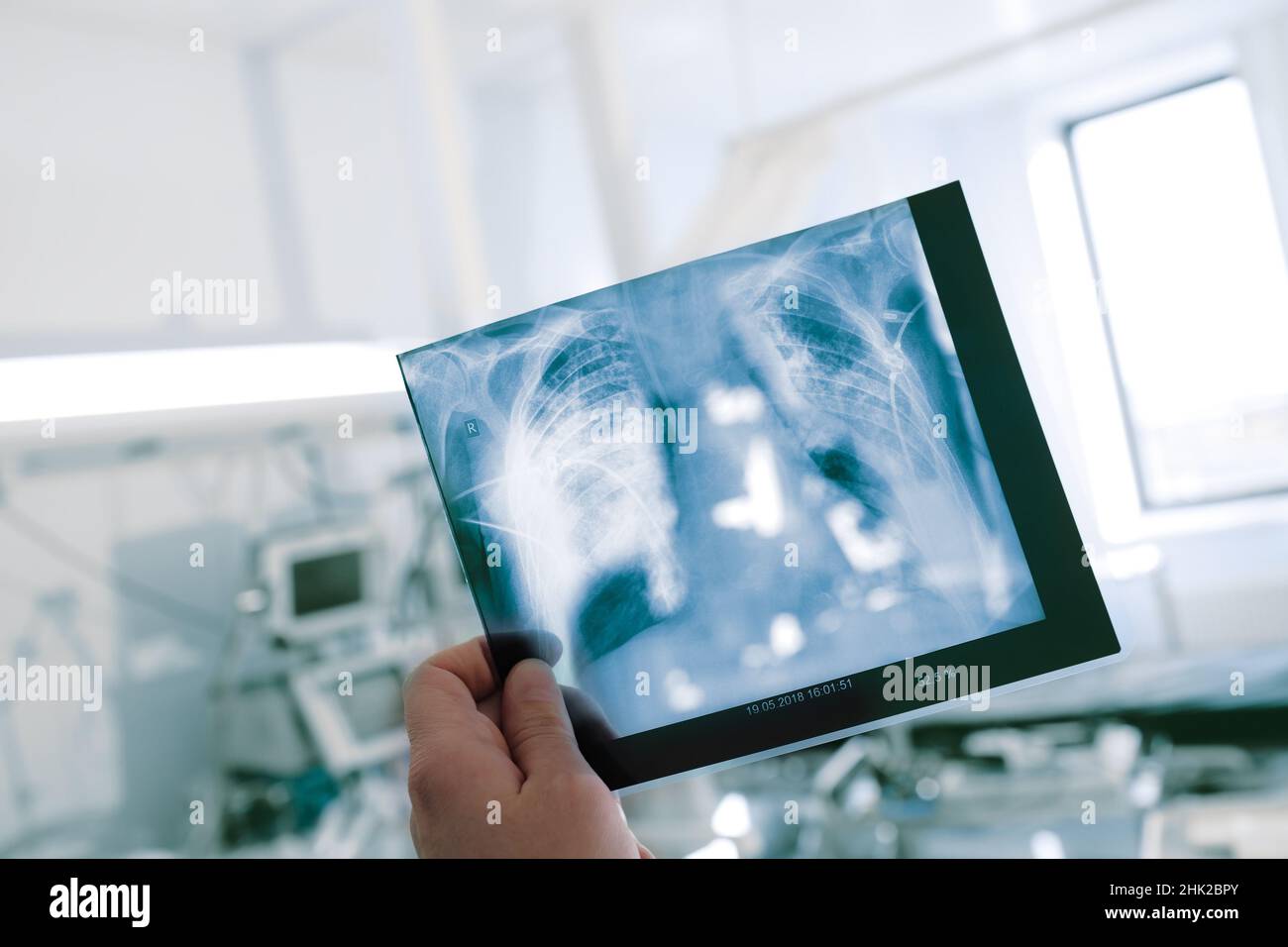 Medical worker holding X-ray picture of patient thorax on the background of hospital ward. Stock Photo
