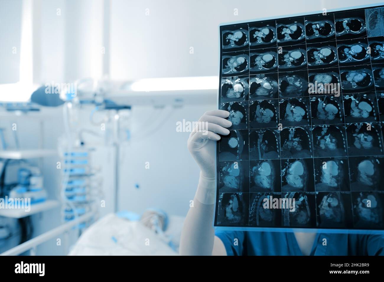 Female doctor looks at the scan image of patient thoracic organs in the hospital room. Stock Photo