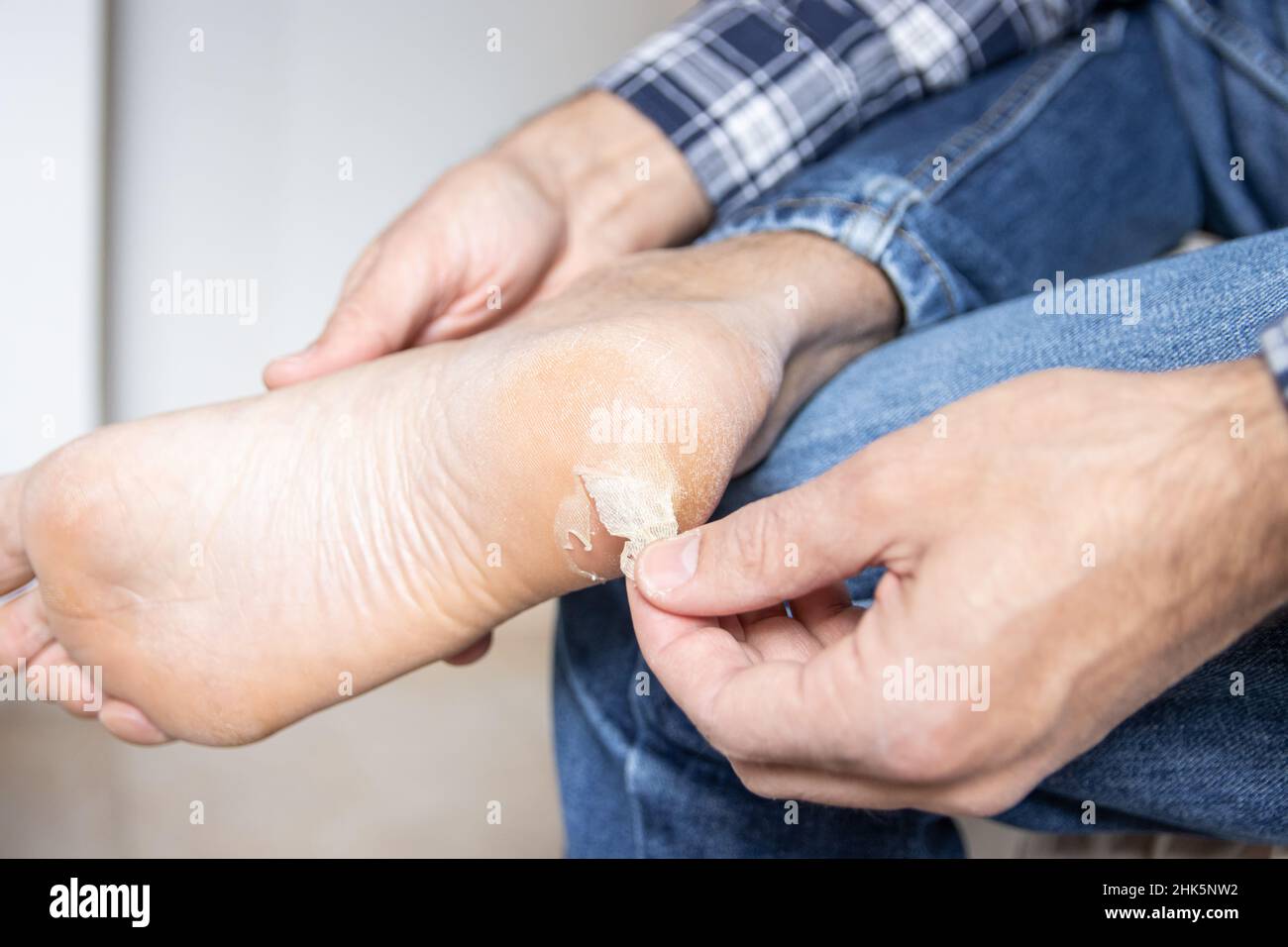 Broken blister hires stock photography and images Alamy