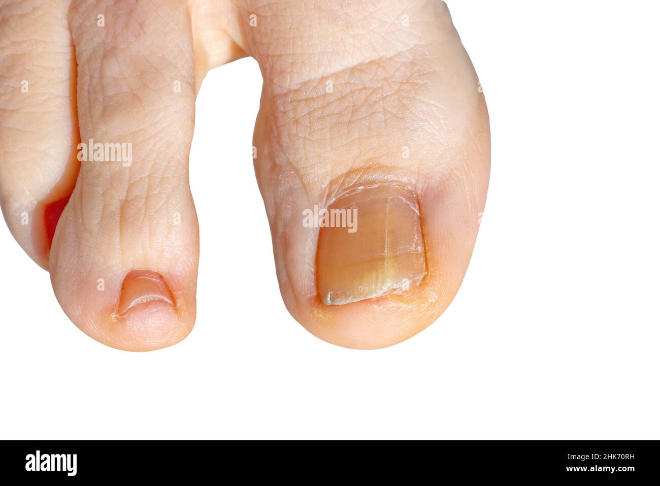 24Pcs Diamond Studded Toe Nail Art Nail Artistic Toe Nail Finished  Artificial Acrylic White ToeNail Removable Press On Toe Nails - AliExpress