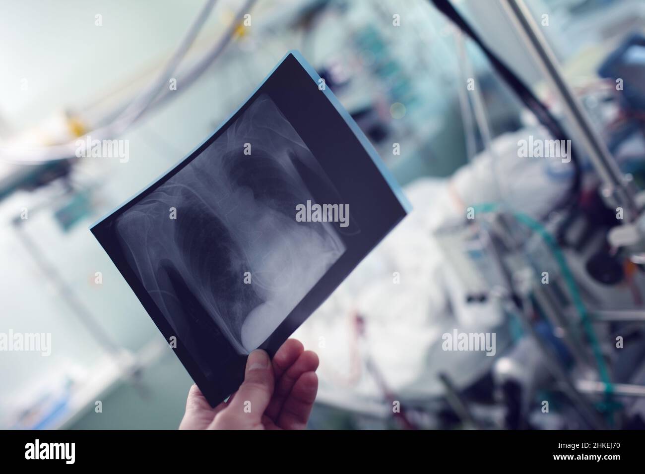 Doctor holds the plain chest radiograph of patient in the ER Stock ...