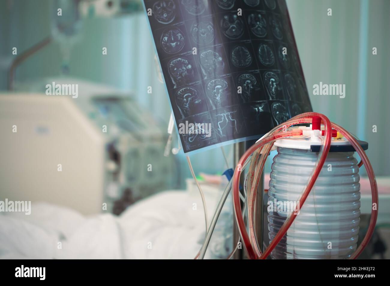 MRI image next to the patient bed surrounded by advanced equipment in the critical care unit. Stock Photo