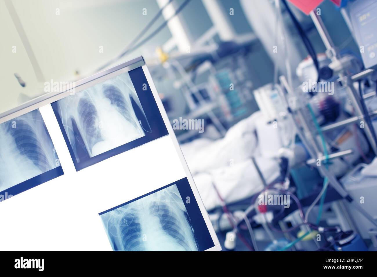 Radiological control images on the negatoscope in the patient ward. Stock Photo