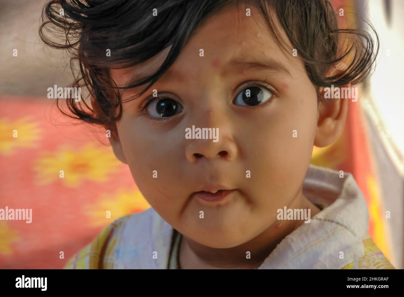 Baby girl chickenpox hi-res stock photography and images - Alamy