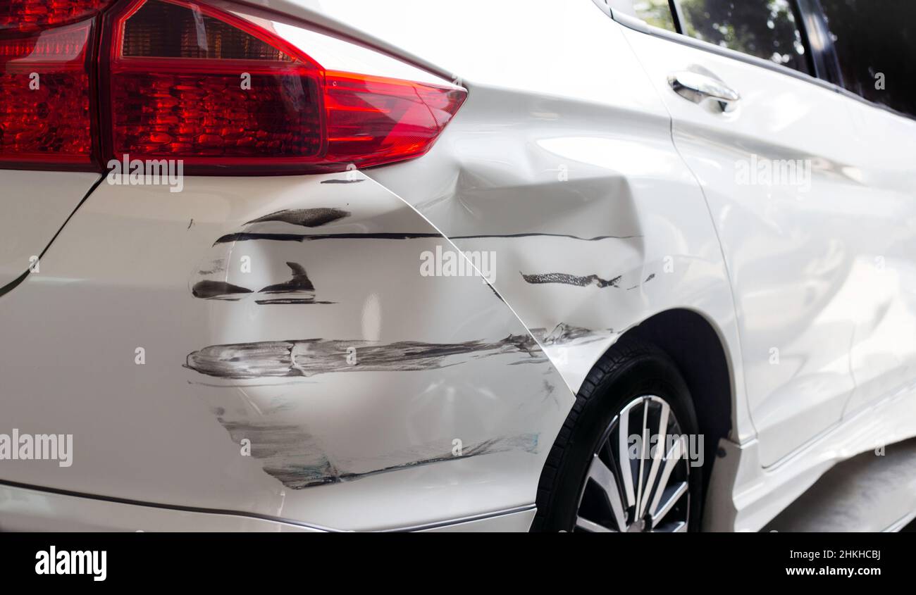 Evidence of car accident injuries Used for detecting offenders on cars. For insurance and investigative businesses Stock Photo