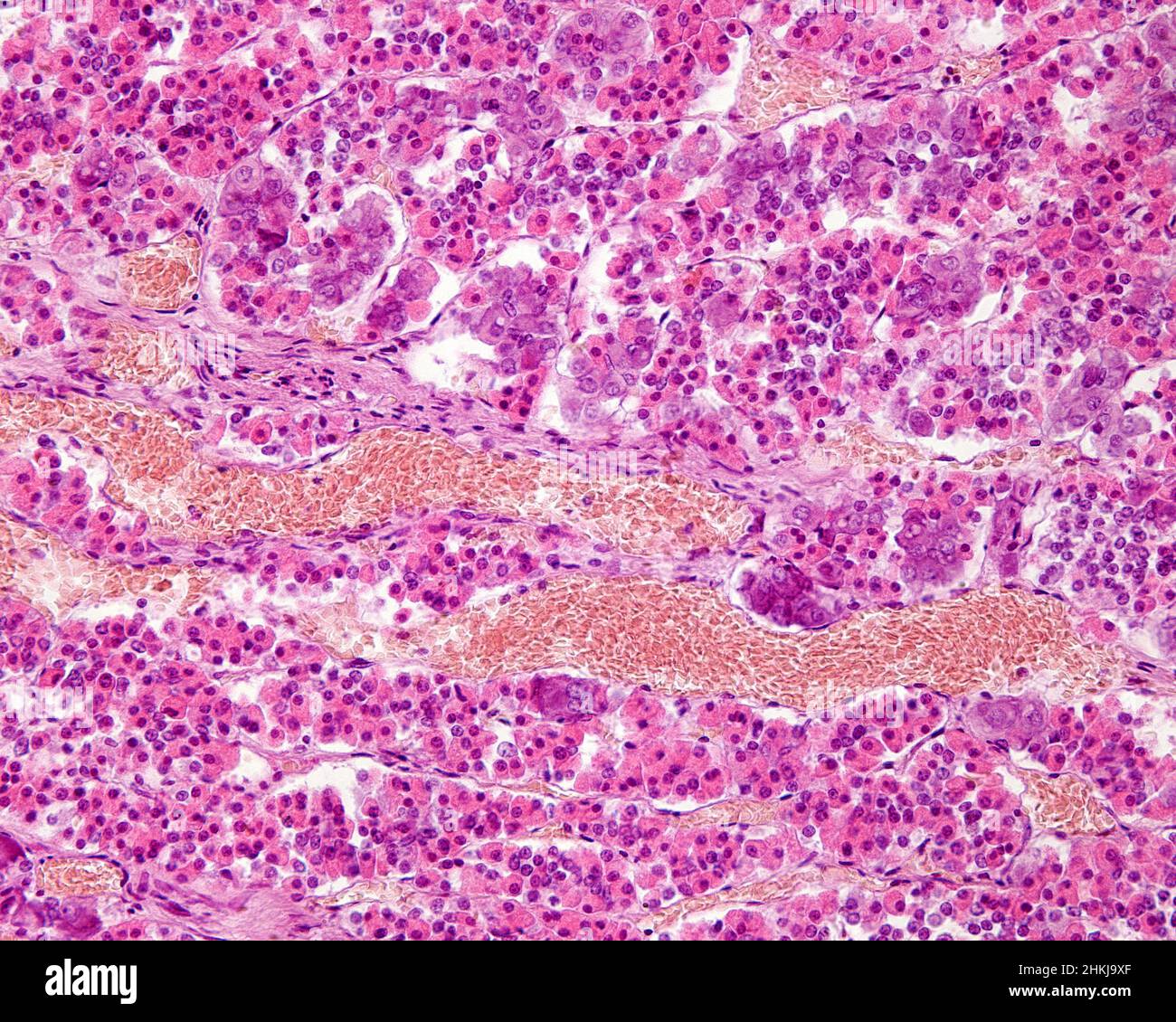 Anterior lobe of pituitary gland, light micrograph Stock Photo - Alamy