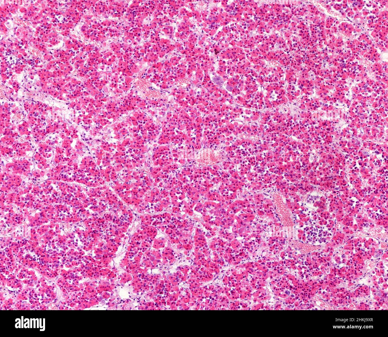 Anterior lobe of pituitary gland, light micrograph Stock Photo - Alamy