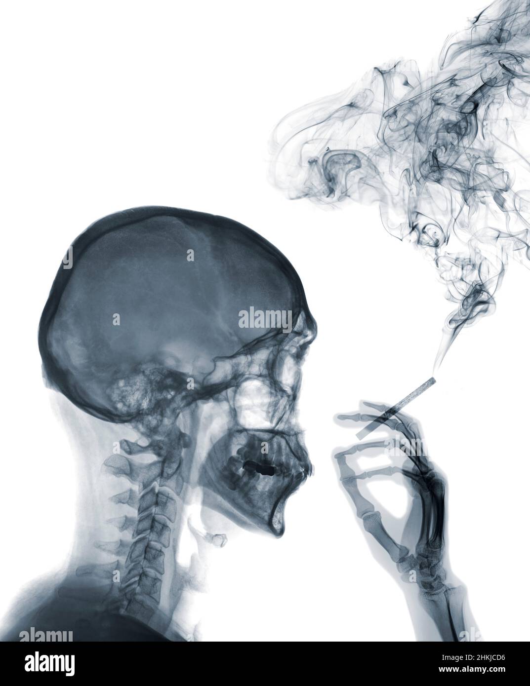 Person smoking a cigarette, X-ray Stock Photo