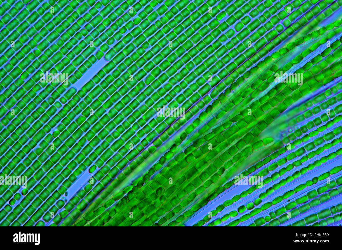 Filamentous green algae, polarised light micrograph Stock Photo