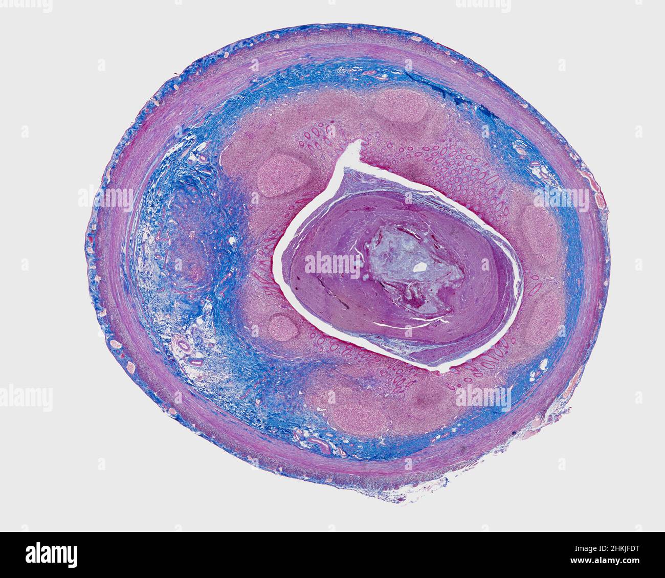 Appendix, light micrograph Stock Photo - Alamy