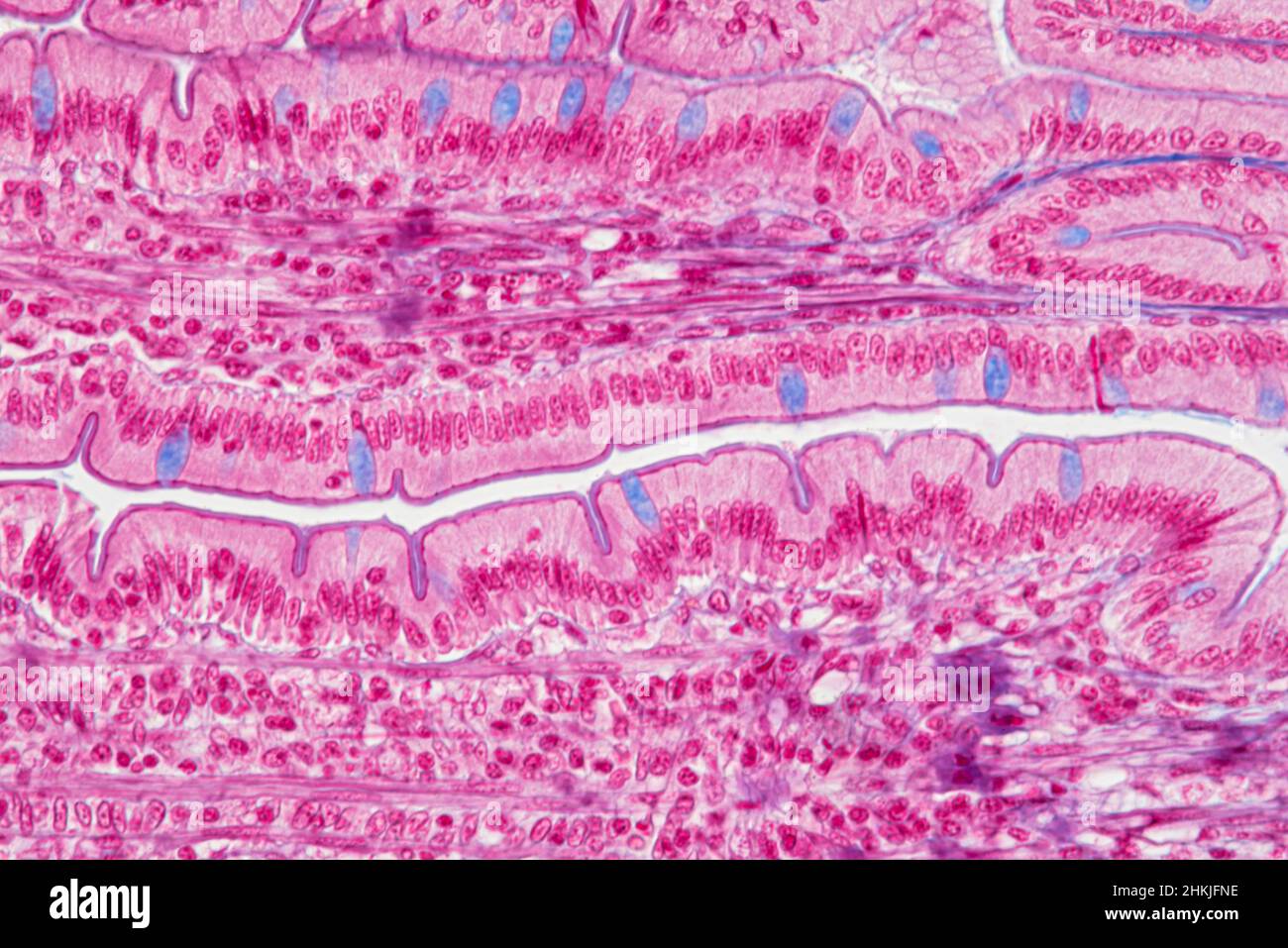 Small intestine, light micrograph Stock Photo - Alamy