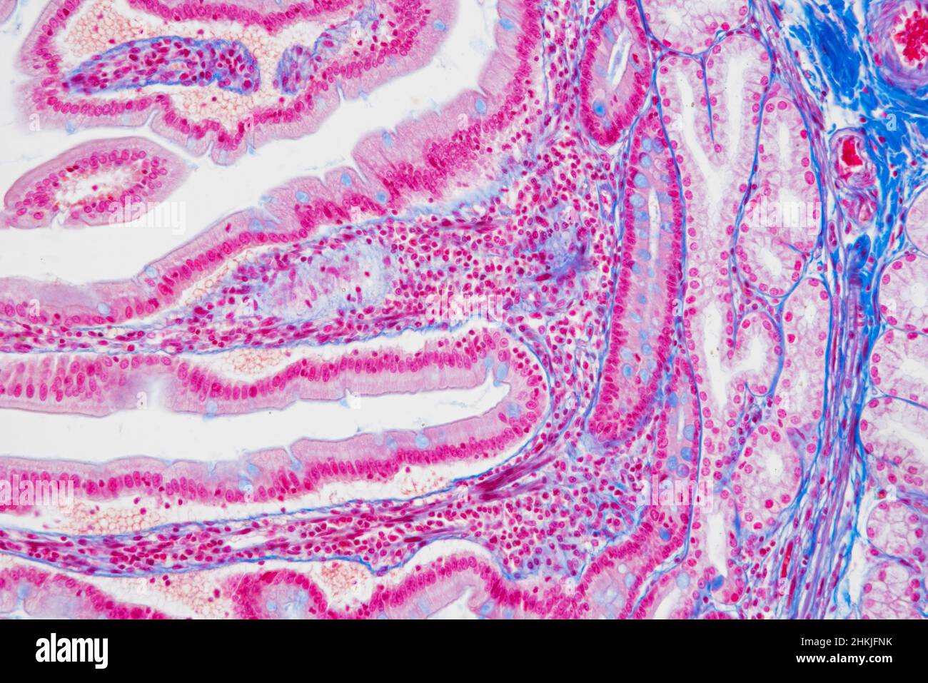 Small intestine, light micrograph Stock Photo - Alamy