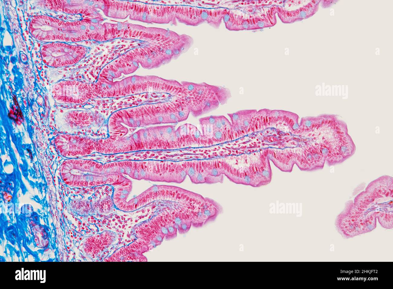 Small intestine, light micrograph Stock Photo - Alamy