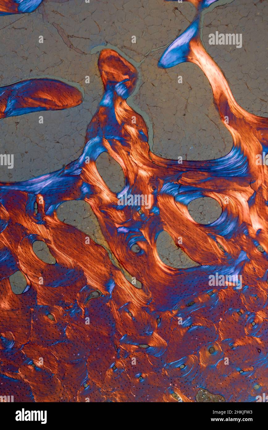 Bone tissue, light micrograph Stock Photo - Alamy