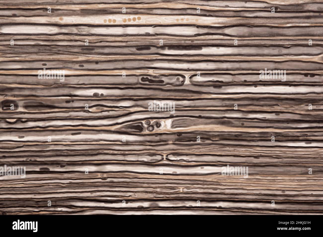 Nerve fibres, light micrograph Stock Photo - Alamy