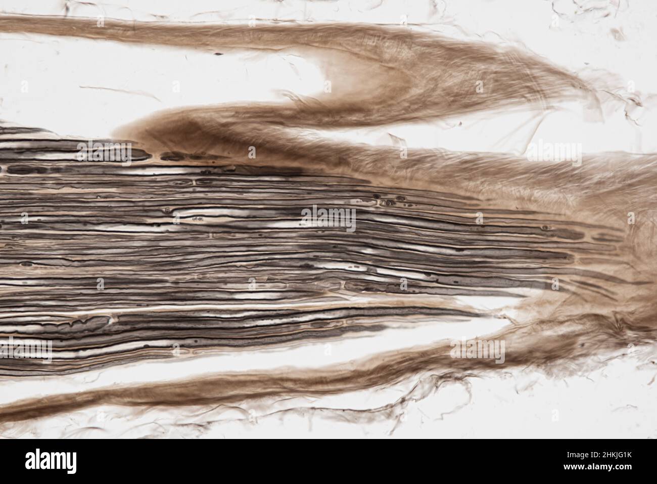 Nerve fibres, light micrograph Stock Photo - Alamy