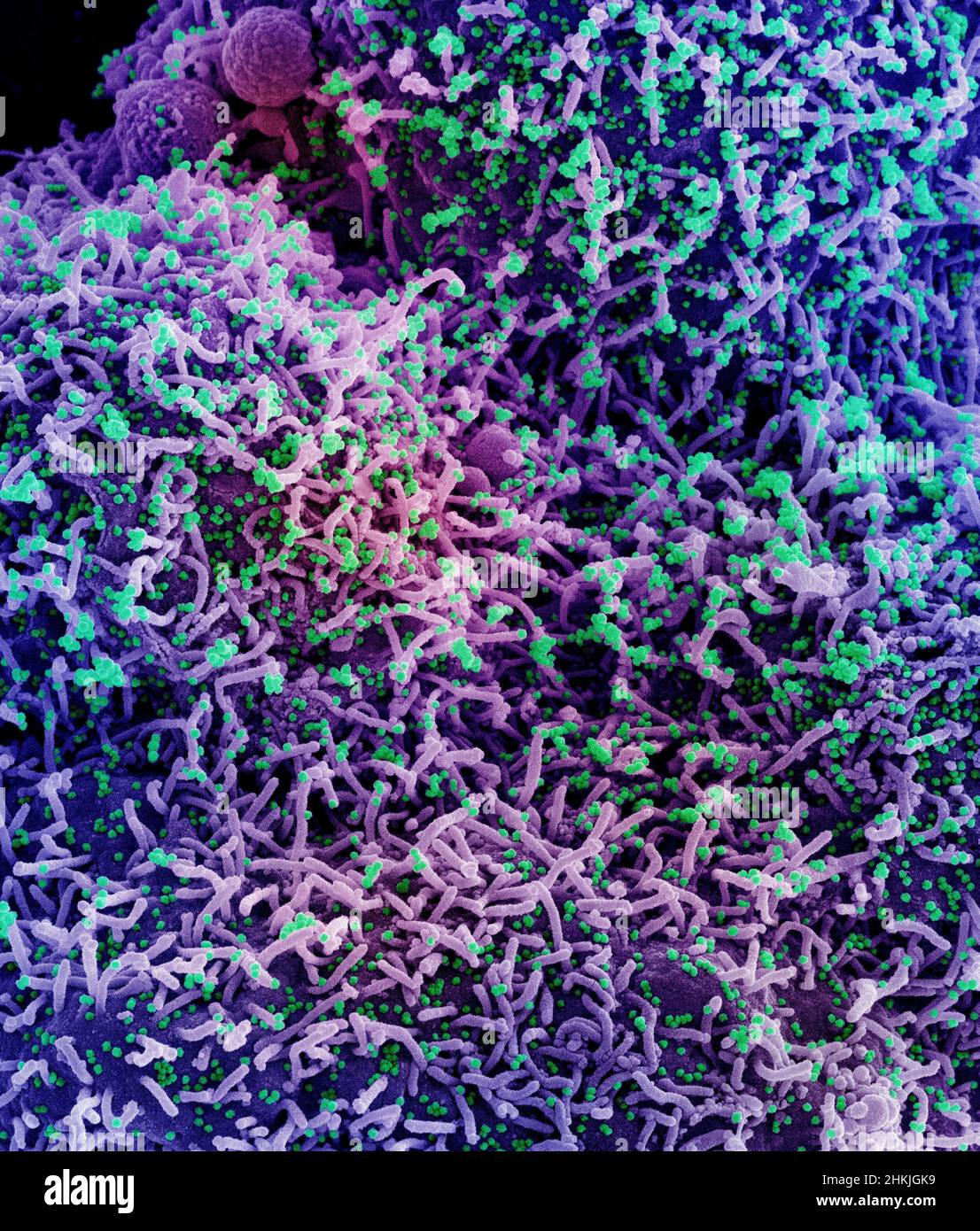 Cell infected by SARS-Cov-2 virus particles, SEM Stock Photo - Alamy
