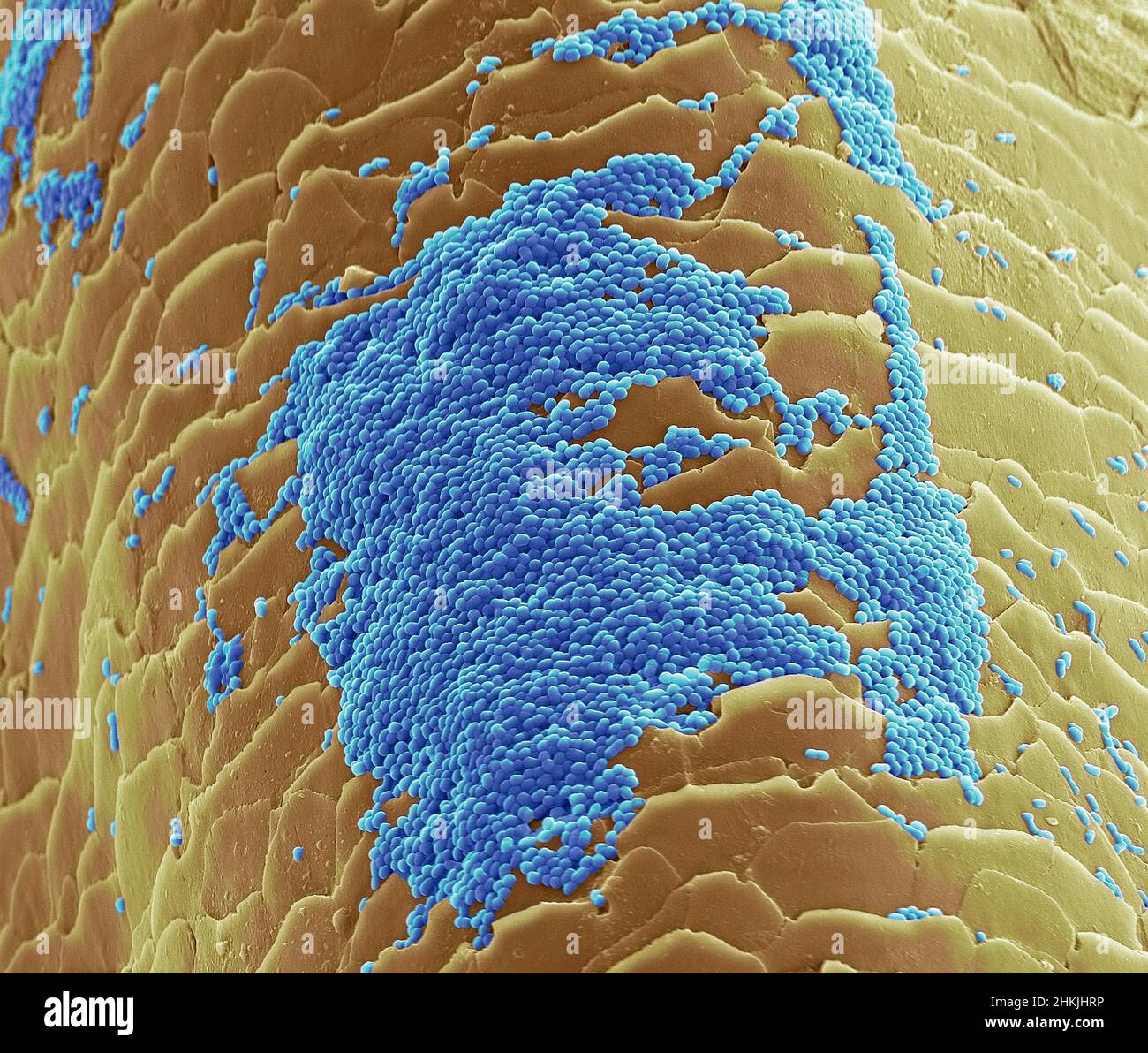 Skin bacteria on hair, SEM Stock Photo Alamy